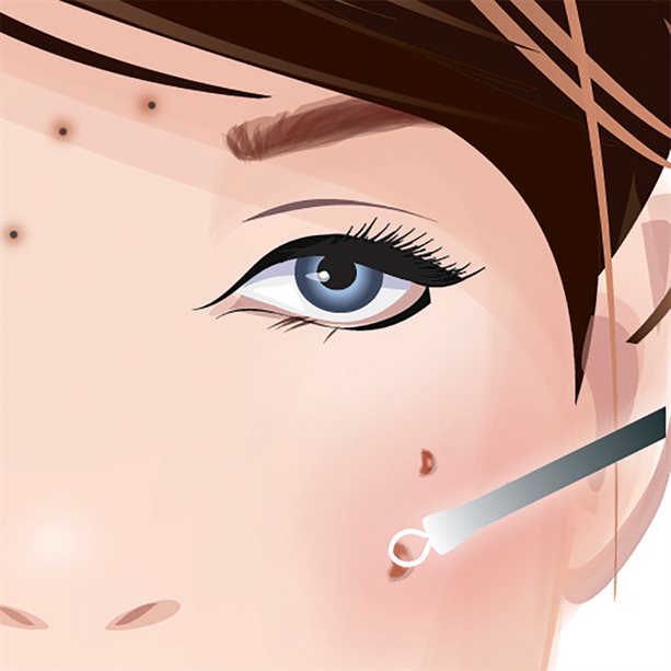 Blackhead Remover Tool 1 piece Avon South Africa